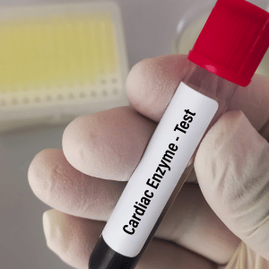 Cardiac Biomarkers for MI (Heart Attack Risk)